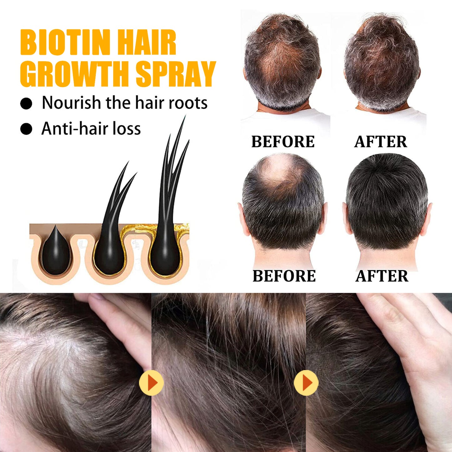 Biotin Hair Growth Spray, Strong Anti-Rip Repair Hair Care And Root Stabilization Spray
