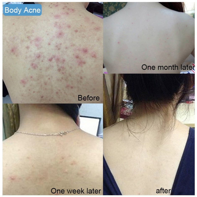 صابون ملح البحر - قالب طبيعي لتفتيح وترطيب البشرة