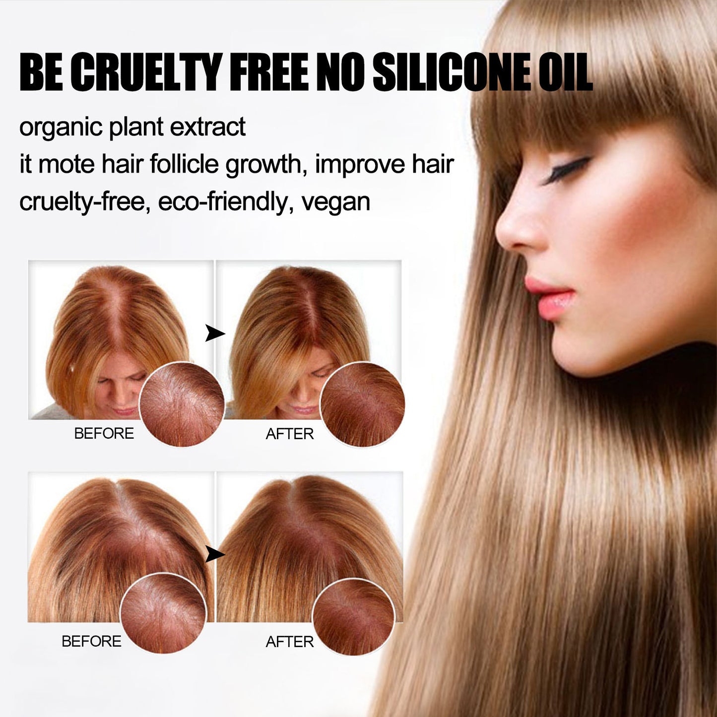 صابون شامبو الزنجبيل - مضاد لتساقط الشعر وعناية بفروة الرأس