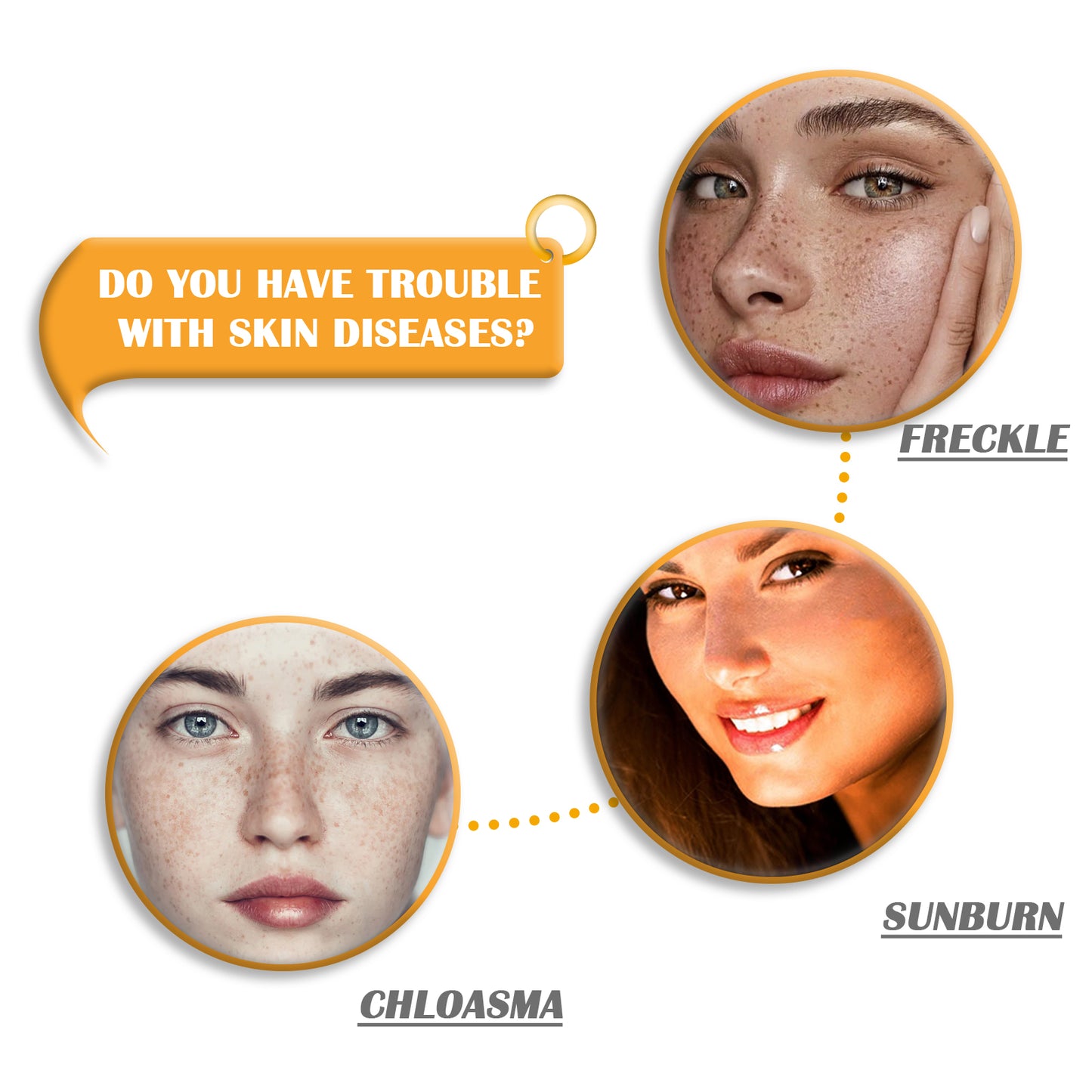 صابون حمض الكوجيك - منظف لتفتيح البشرة وتنظيف المسام