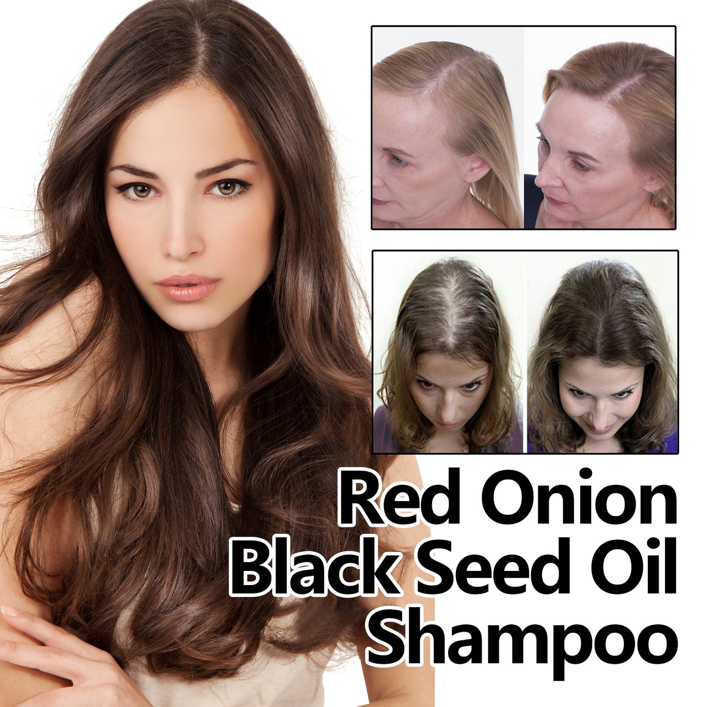 Eelhoe Red Onion And Black Seed Oil Hair Care Essential Oil, Nourishing And Nourishing Hair, Smoothing And Repairing Dry Hair