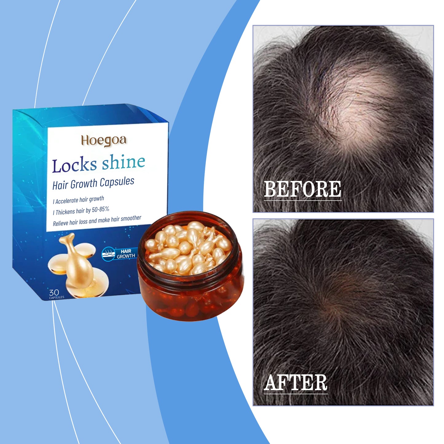 كبسولات العناية المكثفة بالشعر - إصلاح وتنعيم فروة الرأس