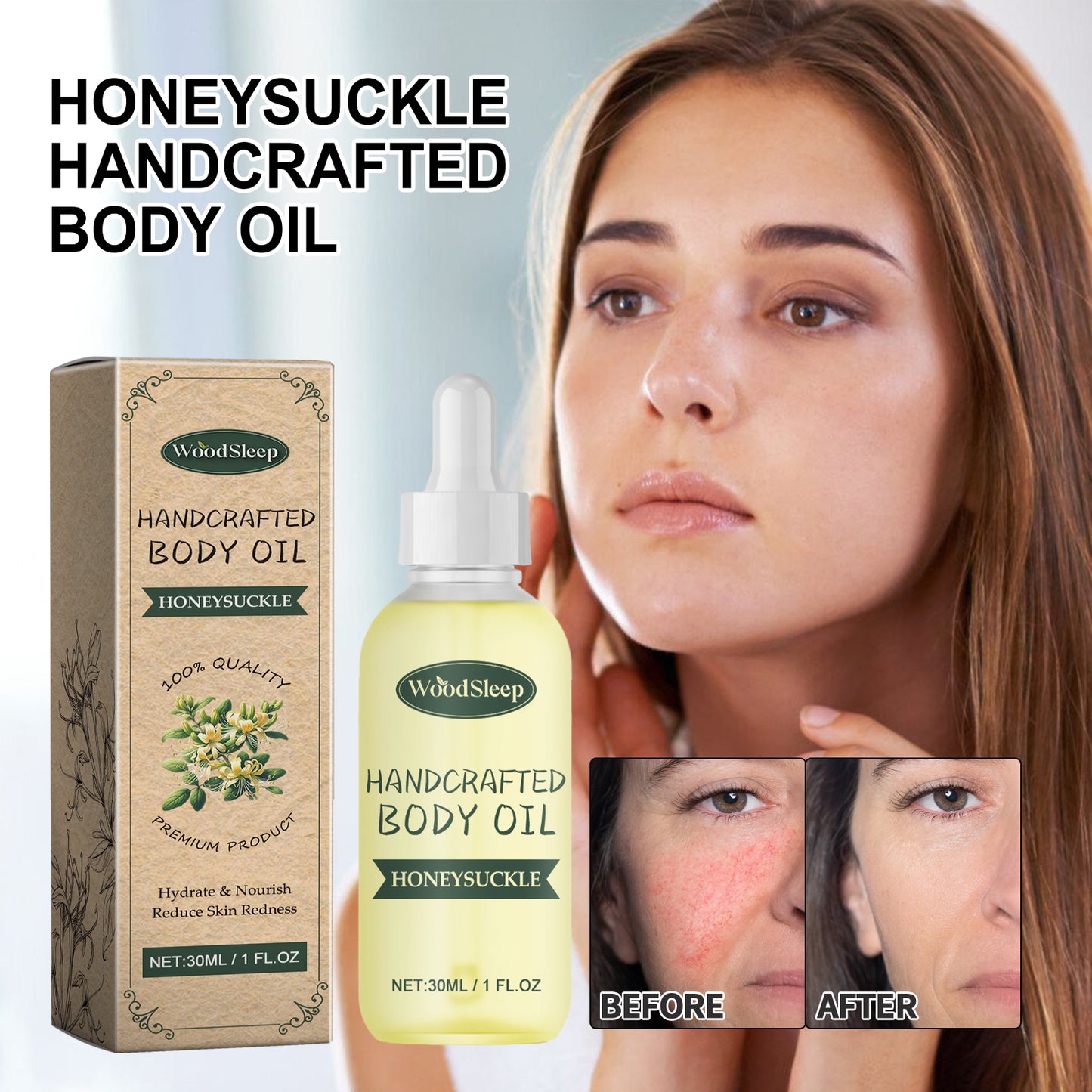 زيت الجسم المصنوع يدويًا برائحة زهر العسل، يُصلح احمرار الوجه ويُخفف آثار الندبات، زيت عطري متعدد الاستخدامات للجسم